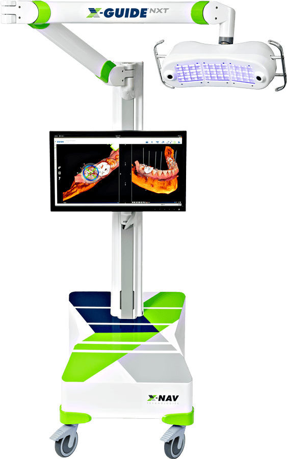 x-guide dynamic navigation machine